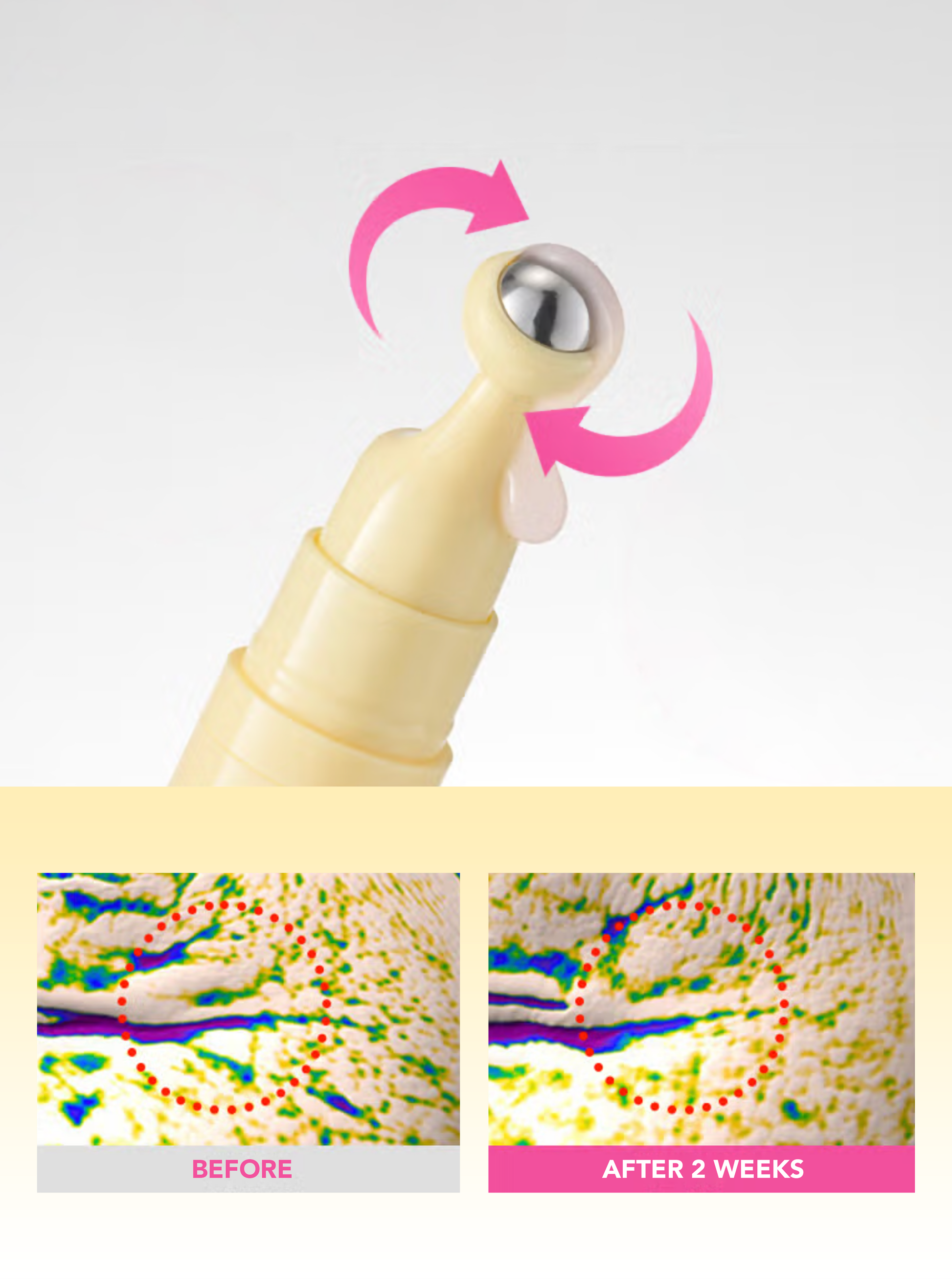 Before and after results – firmer, smoother eye contour
